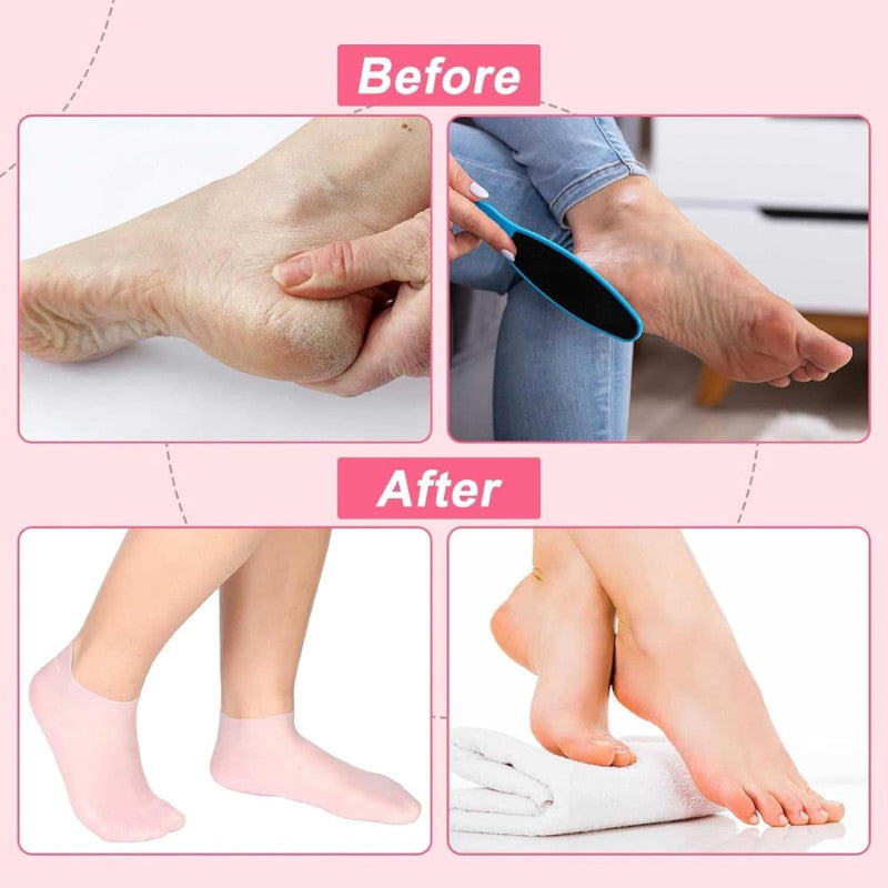 1 Pair Silicone Socks Silicone Gel Sock Silicone Moisturizing Sock Silicone Heel Sock